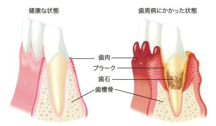 一般歯科図版